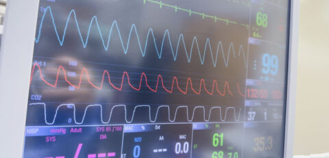 eletrocardiograma eletrocardiograma