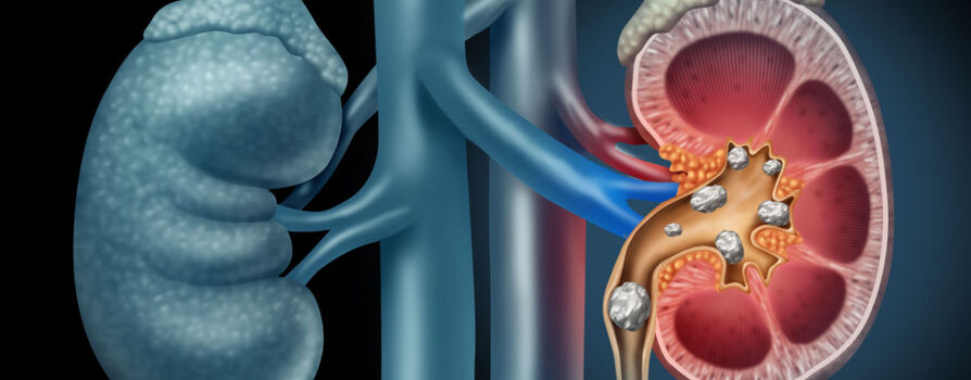 Quando procurar um nefrologista